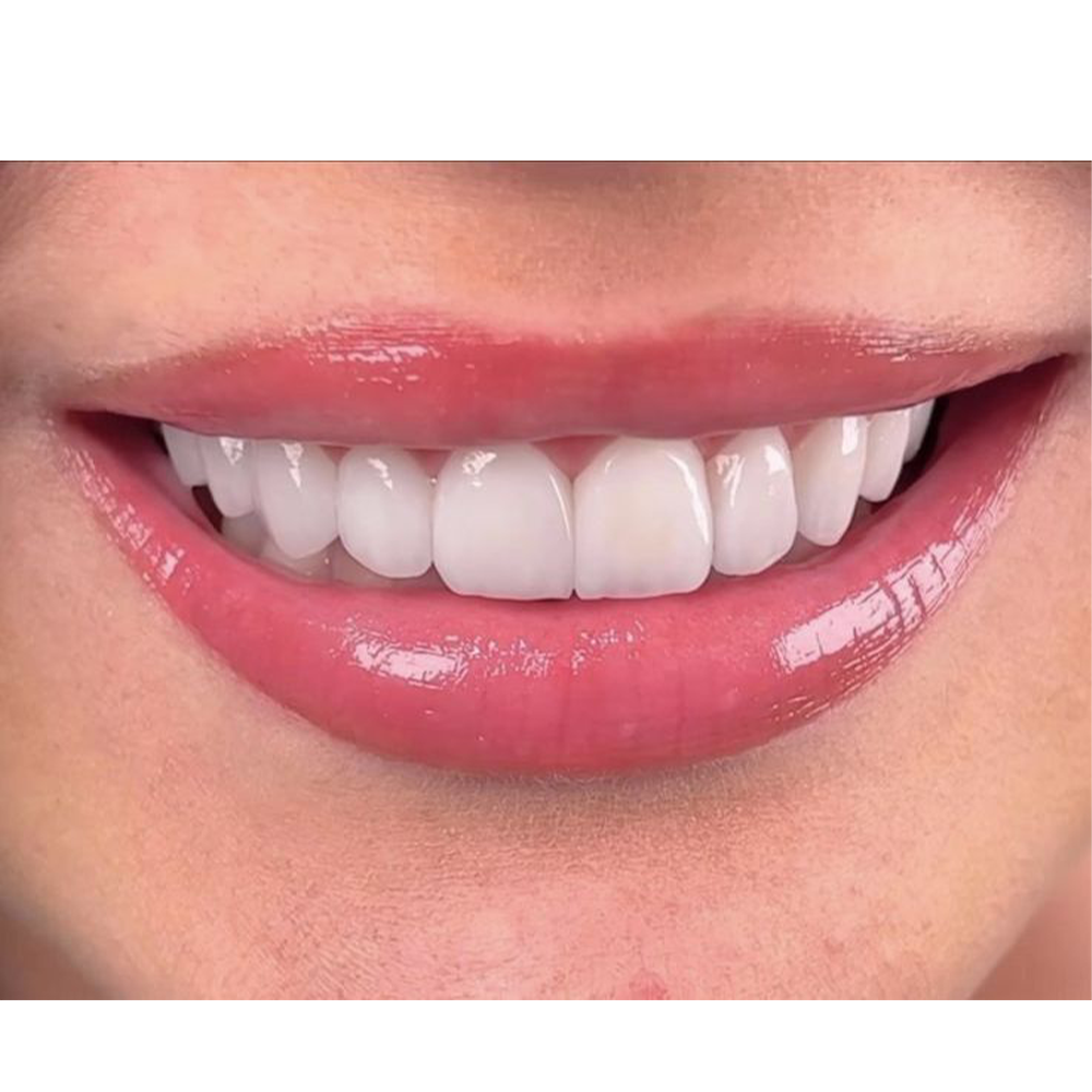 Dental Treatments
